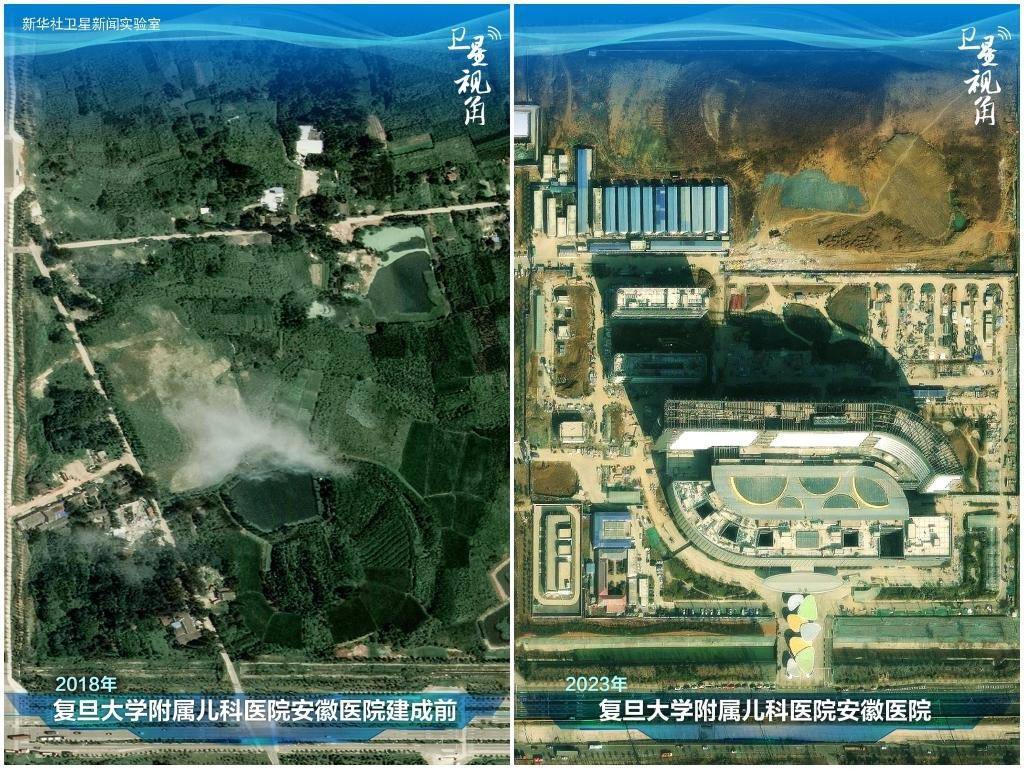 2023年與2018年相比，復(fù)旦大學(xué)附屬兒科醫(yī)院安徽醫(yī)院從一片荒地到建成投用。該項(xiàng)目是安徽省在長三角一體化高質(zhì)量發(fā)展衛(wèi)生健康領(lǐng)域的重大項(xiàng)目，也是安徽首批落地的國家區(qū)域醫(yī)療中心。